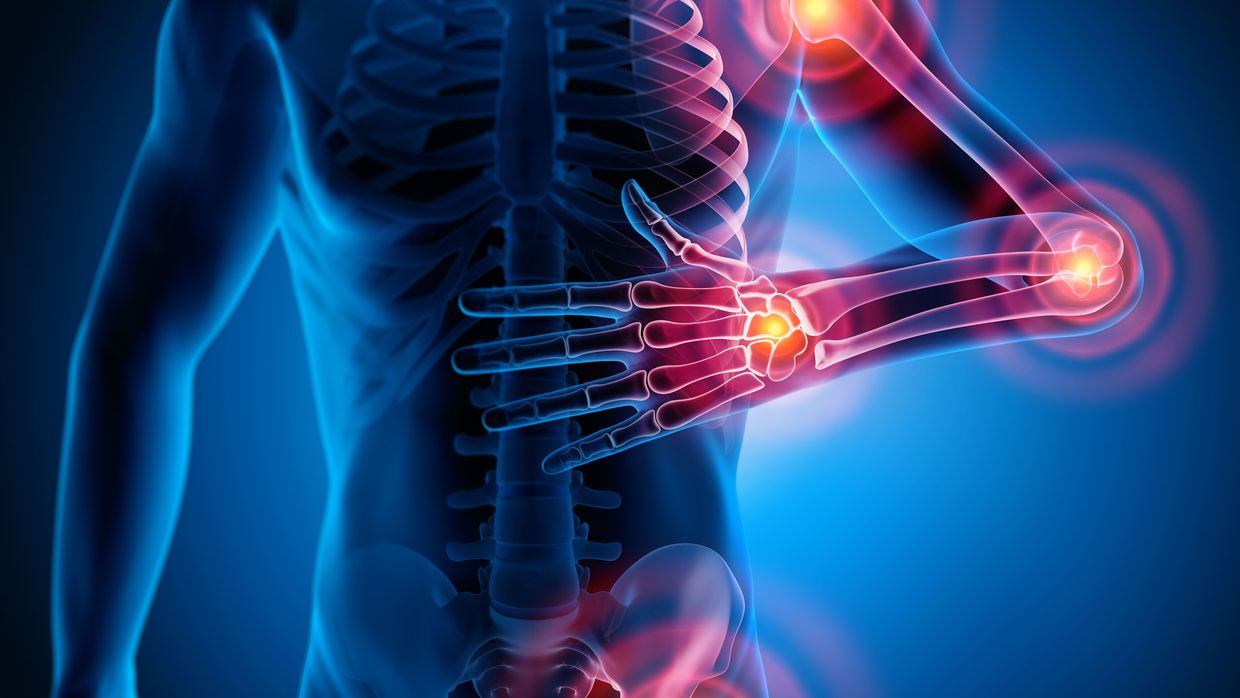 Schmerzen In Allen Muskeln Und Gelenken www.universimed.com